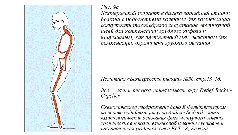 view x ray polarimetry